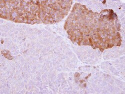 Invitrogen IL22RA2 Polyclonal Antibody 100 &mu;L; Unconjugated:Antibodies,