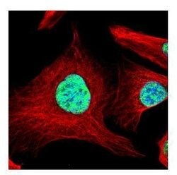 Invitrogen SART1 Polyclonal Antibody 100 &mu;L | Buy Online | Invitrogen&trade; | Fisher Scientific