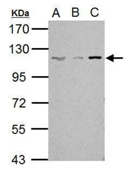 Invitrogen SART1 Polyclonal Antibody 100 &mu;L | Buy Online | Invitrogen&trade; | Fisher Scientific