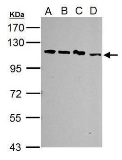 Invitrogen SART1 Polyclonal Antibody 100 &mu;L | Buy Online | Invitrogen&trade; | Fisher Scientific