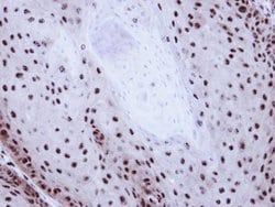 Invitrogen GABPB1 Polyclonal Antibody 100 μL; Unconjugated:Antibodies,