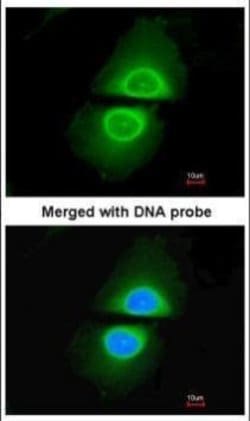 Invitrogen CYP4A11 Polyclonal Antibody 100 μL; Unconjugated:Antibodies,