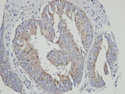 Invitrogen CYP4A11 Polyclonal Antibody 100 μL; Unconjugated:Antibodies,