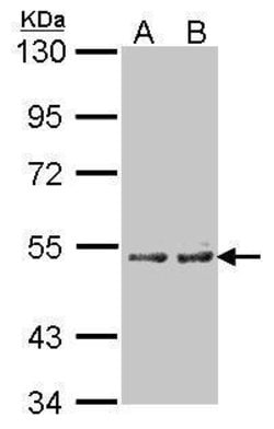 Invitrogen CYP4A11 Polyclonal Antibody 100 μL; Unconjugated:Antibodies,