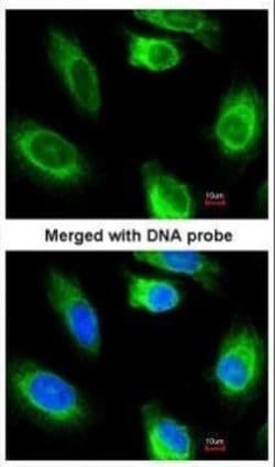 Invitrogen GK2 Polyclonal Antibody 100 &mu;L; Unconjugated:Antibodies,
