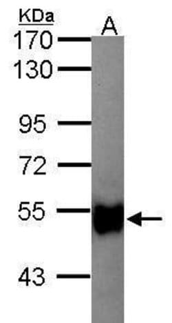 Invitrogen GK2 Polyclonal Antibody 100 &mu;L; Unconjugated:Antibodies,