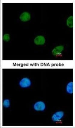 Invitrogen ZNF211 Polyclonal Antibody 100 μL; Unconjugated:Antibodies,