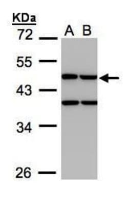 Invitrogen Creatine Kinase MT Polyclonal Antibody 100 μL; Unconjugated:Antibodies,