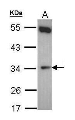Invitrogen CYB5R1 Polyclonal Antibody 100 &mu;L; Unconjugated:Antibodies,