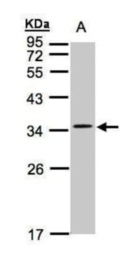Invitrogen CACNG5 Polyclonal Antibody 100 &mu;L:Antibodies, Polyclonal