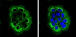 Invitrogen Laminin beta-3 Polyclonal Antibody 100 &mu;L; Unconjugated:Antibodies,
