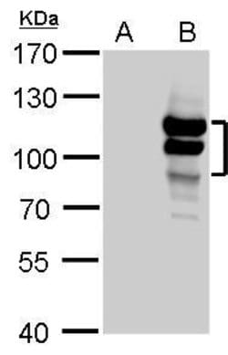 Invitrogen L3MBTL1 Polyclonal Antibody 100 &mu;L; Unconjugated:Antibodies,