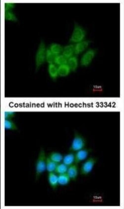 Invitrogen Angiotensinogen Polyclonal Antibody 100 &mu;L; Unconjugated:Antibodies,
