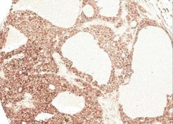 Invitrogen Angiotensinogen Polyclonal Antibody 100 &mu;L; Unconjugated:Antibodies,