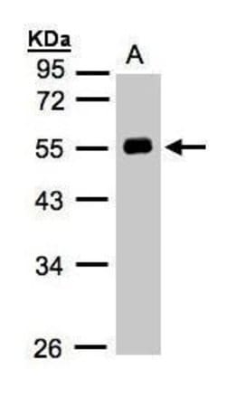 Invitrogen Angiotensinogen Polyclonal Antibody 100 &mu;L; Unconjugated:Antibodies,