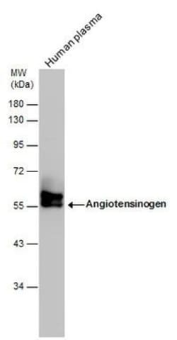 Invitrogen Angiotensinogen Polyclonal Antibody 100 &mu;L; Unconjugated:Antibodies,