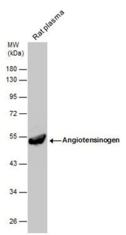 Invitrogen Angiotensinogen Polyclonal Antibody 100 &mu;L; Unconjugated:Antibodies,