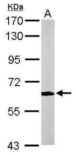 Invitrogen MPP2 Polyclonal Antibody 100 &mu;L; Unconjugated:Antibodies,