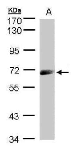 Invitrogen IL12RB1 Polyclonal Antibody 100 &mu;L; Unconjugated:Antibodies,