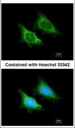 Invitrogen MRPS5 Polyclonal Antibody 100 &mu;L | Buy Online | Invitrogen&trade; | Fisher Scientific