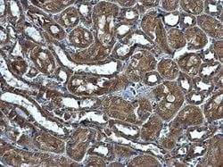 Invitrogen MRPS5 Polyclonal Antibody 100 &mu;L | Buy Online | Invitrogen&trade; | Fisher Scientific