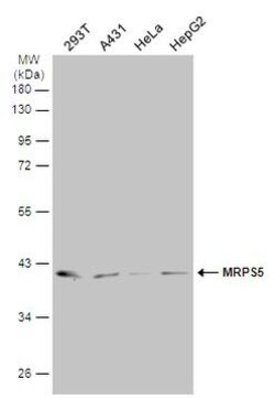 Invitrogen MRPS5 Polyclonal Antibody 100 &mu;L | Buy Online | Invitrogen&trade; | Fisher Scientific