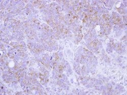 Invitrogen ST3GAL2 Polyclonal Antibody 100 &mu;L; Unconjugated:Antibodies,