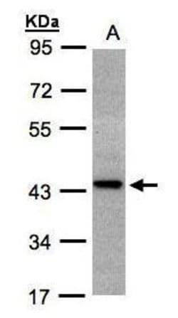 Invitrogen ST3GAL2 Polyclonal Antibody 100 &mu;L; Unconjugated:Antibodies,