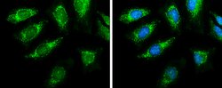 Invitrogen PDHA1 Polyclonal Antibody 100 &mu;L; Unconjugated:Antibodies,