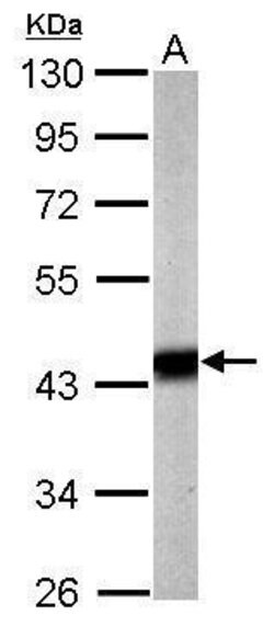Invitrogen PDHA1 Polyclonal Antibody 100 &mu;L; Unconjugated:Antibodies,