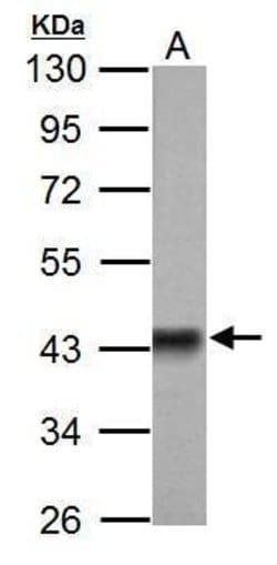 Invitrogen PDHA1 Polyclonal Antibody 100 &mu;L; Unconjugated:Antibodies,