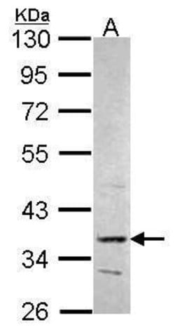 Invitrogen PRPS2 Polyclonal Antibody 100 &mu;L | Buy Online | Invitrogen&trade; | Fisher Scientific
