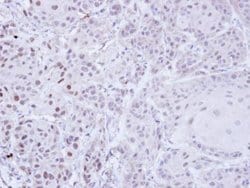 Invitrogen ZNF165 Polyclonal Antibody 100 &mu;L; Unconjugated:Antibodies,