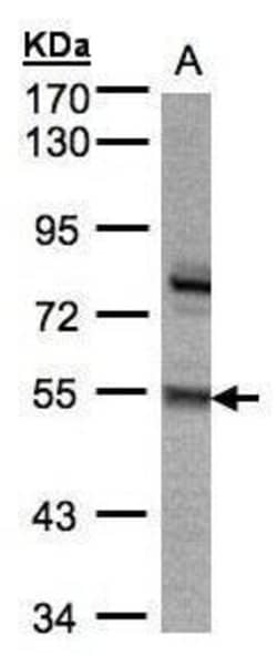 Invitrogen ZNF165 Polyclonal Antibody 100 &mu;L; Unconjugated:Antibodies,