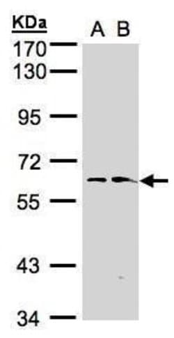 Invitrogen FMO1 Polyclonal Antibody 100 &mu;L; Unconjugated:Antibodies,