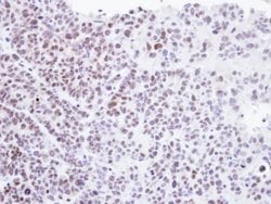 Invitrogen HMBOX1 Polyclonal Antibody 100 &mu;L; Unconjugated:Antibodies,