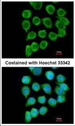 TNFRSF19L Polyclonal Antibody, Invitrogen 100 &mu;L; Unconjugated:Antibodies,