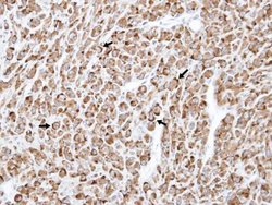 TNFRSF19L Polyclonal Antibody, Invitrogen 100 &mu;L; Unconjugated:Antibodies,