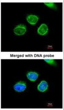 Invitrogen AKR7A2 Polyclonal Antibody 100 &mu;L; Unconjugated:Antibodies,