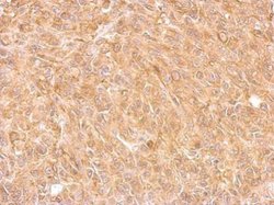 Invitrogen AKR7A2 Polyclonal Antibody 100 &mu;L; Unconjugated:Antibodies,