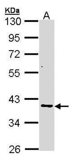 Invitrogen AKR7A2 Polyclonal Antibody 100 &mu;L; Unconjugated:Antibodies,