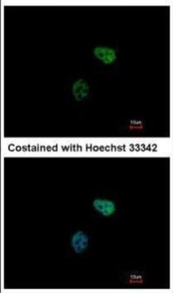 Invitrogen PSMC6 Polyclonal Antibody 100 &mu;L; Unconjugated:Antibodies,