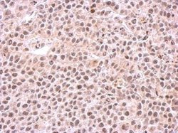 Invitrogen PSMC6 Polyclonal Antibody 100 &mu;L; Unconjugated:Antibodies,