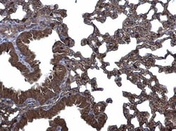 Invitrogen CLIC3 Polyclonal Antibody 100 &mu;L | Buy Online | Invitrogen&trade; | Fisher Scientific