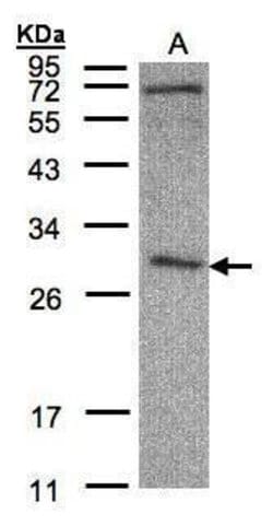 Invitrogen CLIC3 Polyclonal Antibody 100 &mu;L | Buy Online | Invitrogen&trade; | Fisher Scientific
