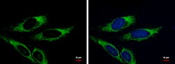 Invitrogen Adenylate Kinase 4 Polyclonal Antibody 100 &mu;L; Unconjugated:Antibodies,