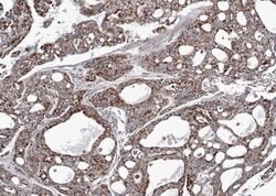 Invitrogen Adenylate Kinase 4 Polyclonal Antibody 100 &mu;L; Unconjugated:Antibodies,