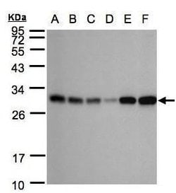 Invitrogen Adenylate Kinase 4 Polyclonal Antibody 100 &mu;L; Unconjugated:Antibodies,