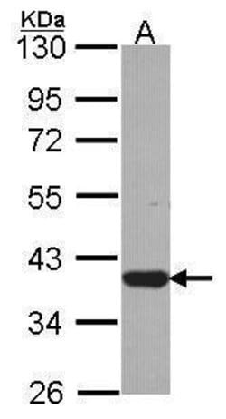 Invitrogen LZTFL1 Polyclonal Antibody 100 &mu;L; Unconjugated:Antibodies,