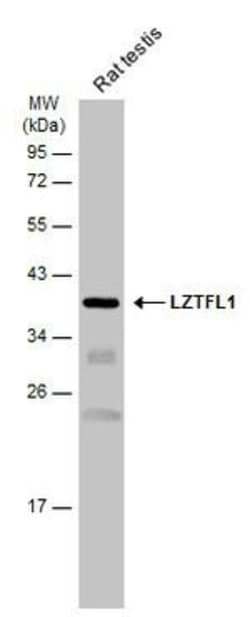 Invitrogen LZTFL1 Polyclonal Antibody 100 &mu;L; Unconjugated:Antibodies,